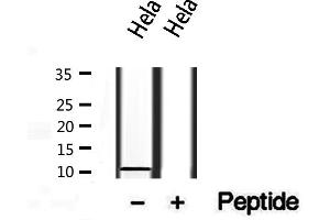 Western blot analysis of extracts from Hela, using S100A14 antibody.