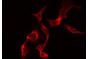 ABIN6268965 staining HuvEc by IF/ICC. (HNRNPD/AUF1 Antikörper  (Internal Region))