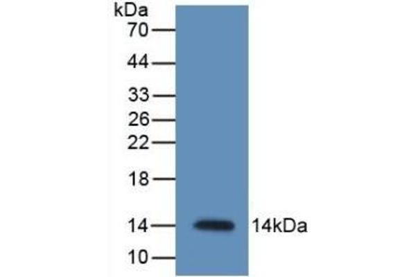 Resistin Antikörper  (AA 21-114)