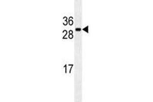 CDCA8 antibody western blot analysis in U251 lysate (CDCA8 Antikörper)