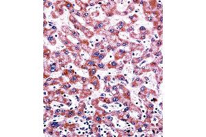CYP2C9 Antibody immunohistochemistry analysis in formalin fixed and paraffin embedded human liver tissue followed by peroxidase conjugation of the secondary antibody and DAB staining. (CYP2C9 Antikörper  (N-Term))