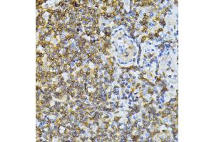 Immunohistochemistry of paraffin-embedded human tonsil using ND5 antibody (ABIN6294088) at dilution of 1:100 (40x lens). (MT-ND5 Antikörper)