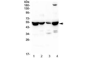 Western blot testing of 1) rat liver, 2) rat kidney, 3) rat lung and 4) mouse liver lysate with ASL antibody at 0. (Adenylosuccinate Lyase Antikörper)