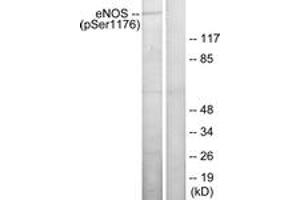 Western Blotting (WB) image for anti-Nitric Oxide Synthase 3 (Endothelial Cell) (NOS3) (pSer1176) antibody (ABIN2888406) (ENOS Antikörper  (pSer1176))