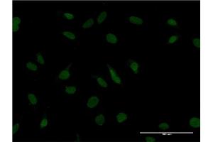 Immunofluorescence of monoclonal antibody to ZBTB20 on HeLa cell.