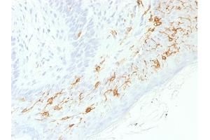 Formalin-fixed, paraffin-embedded human Skin stained with CD1a-Monospecific RecombinantRabbit Monoclonal Antibody (C1A/1506R). (Rekombinanter CD1a Antikörper)