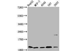 Western Blot Positive WB detected in: HepG2 whole cell lysate, MCF-7 whole cell lysate, A549 whole cell lysate, U87 whole cell lysate, 293T whole cell lysate All lanes: CSTB antibody at 5. (CSTB Antikörper  (AA 1-98))