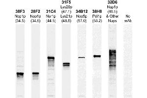 The Western blots of whole yeast protein extracts with a collection of our antibodies.