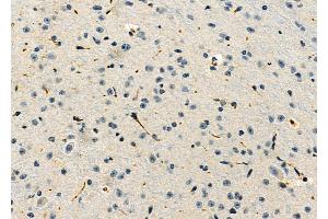 ABIN6263343 and ABIN6276818 at 1/100 staining Mouse brain tissue by IHC-P. (MPZ Antikörper  (C-Term))