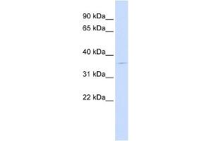 PGBD2 antibody used at 1 ug/ml to detect target protein. (PGBD2 Antikörper  (Middle Region))