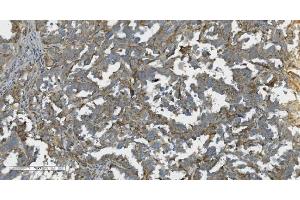 IHC analysis of K Cadherin/CDH6 using anti-K Cadherin/CDH6 antibody (ABIN7600136). (CDH6 Antikörper  (AA 153-424))