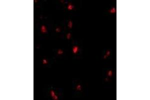 Immunofluorescence of cbl in human lymph node tissue with AP30209PU-N cbl antibody at 20 μg/ml. (CBL Antikörper  (C-Term))