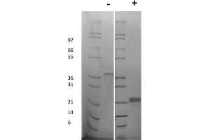 SDS-PAGE (SDS) image for Vascular Endothelial Growth Factor A (VEGFA) protein (ABIN6700875)