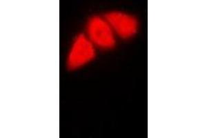 Immunofluorescent analysis of p53 staining in HeLa cells. (p53 Antikörper  (N-Term))