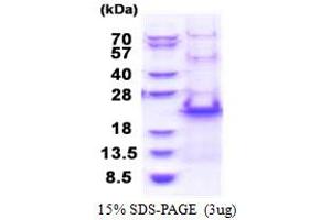 Ribosomal Protein S20 (RPS20) (AA 1-142) protein (His tag)