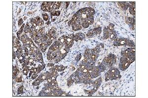 IHC analysis of AS160/TBC1D4 using anti-AS160/TBC1D4 antibody (ABIN7599745). (TBC1D4 Antikörper  (AA 1118-1298))