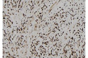 ABIN6273104 at 1/100 staining Human gastric tissue by IHC-P. (CPSF4 Antikörper  (C-Term))