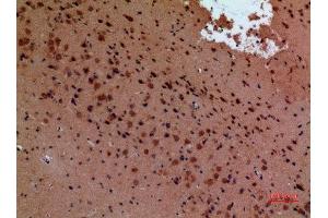 Immunohistochemistry (IHC) analysis of paraffin-embedded Mouse Brain, antibody was diluted at 1:100. (Arginine Antikörper  (Internal Region))