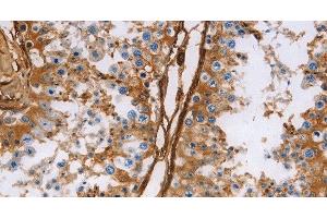 Immunohistochemistry of paraffin-embedded Human testis using Caldesmon Polyclonal Antibody at dilution of 1:40 (Caldesmon Antikörper)