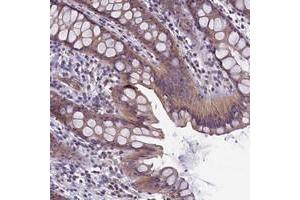 Immunohistochemical staining of human rectum with CACNG8 polyclonal antibody  shows moderate cytoplasmic positivity in glandular cells.
