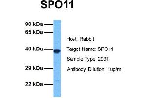 Host: Rabbit Target Name: SPO11 Sample Tissue: Human 293T Antibody Dilution: 1.