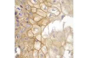 Immunohistochemistry of paraffin-embedded human esophageal using IL7R antibody at dilution of 1:100 (40x lens). (IL7R Antikörper)