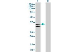 Western Blot analysis of SERPINC1 expression in transfected 293T cell line by SERPINC1 MaxPab polyclonal antibody. (SERPINC1 Antikörper  (AA 1-259))