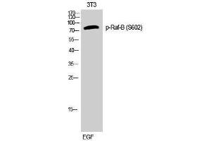 Western Blotting (WB) image for anti-B-Raf proto-oncogene, serine/threonine kinase (BRAF) (pSer602) antibody (ABIN3180448) (BRAF Antikörper  (pSer602))