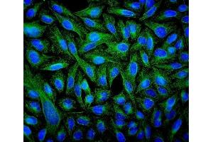 IF analysis of Tubulin beta using anti-Tubulin beta antibody (ABIN7602744). (TUBB Antikörper  (C-Term))