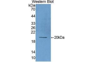 Western Blotting (WB) image for anti-Matrix Metallopeptidase 9 (Gelatinase B, 92kDa Gelatinase, 92kDa Type IV Collagenase) (MMP9) antibody (FITC) (ABIN1173111)