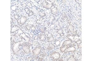 anti-BRCA1 Associated Protein-1 (Ubiquitin Carboxy-terminal Hydrolase) (BAP1) (AA 679-729) antibody