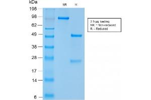 SDS-PAGE Analysis Purified CD56 Rabbit Recombinant Monoclonal Antibody (NCAM1/2217R). (Rekombinanter CD56 Antikörper)