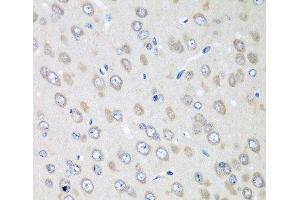 Immunohistochemistry of paraffin-embedded Rat brain using RPN2 Polyclonal Antibody at dilution of 1:100 (40x lens). (Ribophorin II Antikörper)