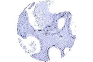 Strong nuclear p63 positivity in basal cells of prostate glands (Rekombinanter TCP1 alpha/CCTA Antikörper  (AA 600-680))