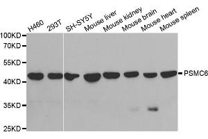 Western blot analysis of extracts of various cell lines, using PSMC6 antibody (ABIN5973113) at 1/1000 dilution. (PSMC6 Antikörper)