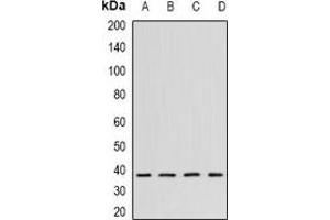 Western blot analysis of CK2 alpha expression in K562 (A), Hela (B), mouse testis (C), mouse brain (D) whole cell lysates.