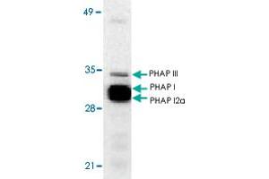 Western blot analysis of ANP32A expression in human Raji cell lysate with ANP32A polyclonal antibody  at 1 ug/mL .