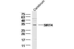 SIRT4 Antikörper  (AA 51-150)