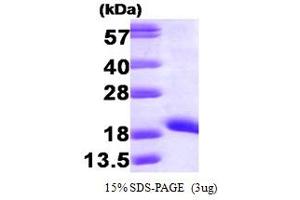 SDS-PAGE (SDS) image for Non-Metastatic Cells 1, Protein (NM23A) Expressed in (NME1) (AA 1-152) protein (ABIN666785)
