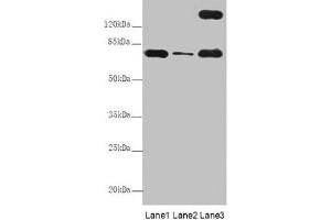 Western Blot All lanes: TTC12 antibody at 8 μg/mL Lane 1: Mouse large intestine tissue Lane 2: Mouse small intestine tissue Lane 3: HepG2 whole cell lysate Secondary Goat polyclonal to rabbit IgG at 1/10000 dilution Predicted band size: 79, 82 kDa Observed band size: 79, 170 kDa (TTC12 Antikörper  (AA 1-260))