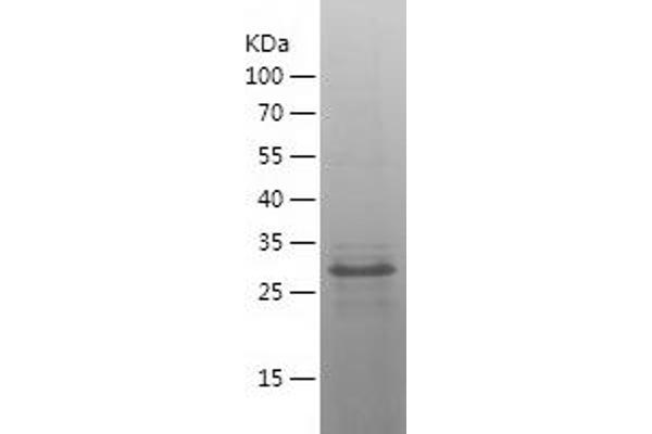 CDX2 Protein (AA 109-313) (His tag)