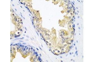 Immunohistochemistry of paraffin-embedded Human prostate using SPINT2 Polyclonal Antibody at dilution of 1:200 (40x lens).