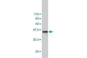 Western Blot detection against Immunogen (36. (Exportin 2 Antikörper  (AA 872-971))
