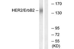 Western blot analysis of extracts from HuvEc cells, using HER2 (Ab-686) Antibody. (ErbB2/Her2 Antikörper  (AA 661-710))