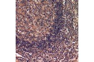 Immunohistochemical analysis of IDH3 alpha staining in human lymph gland formalin fixed paraffin embedded tissue section. (IDH3A Antikörper)