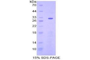 SDS-PAGE analysis of Mouse ENTPD1 Protein. (CD39 Protein)