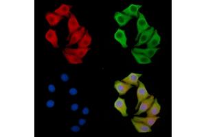 RNF87 Antibody staining Hela cells by IF/ICC. (TRIM4 Antikörper)