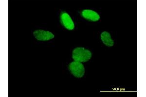 Immunofluorescence of purified MaxPab antibody to L3MBTL3 on HeLa cell.