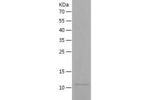 CD9 Protein (CD9) (AA 112-195) (His tag)