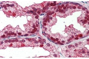 Human Prostate; Immunohistochemistry with Human Prostate lysate tissue at an antibody concentration of 5. (NFIX Antikörper  (Middle Region))
